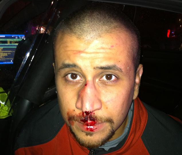 George Zimmerman